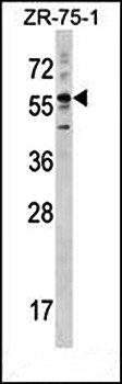 Western blot analysis of ZR-75-1 cell line lysates (35ug/lane) using KRT3 (Center) antibody