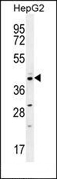 Western blot analysis of HepG2 cell line lysates (35ug/lane) using CCNI2 antibody (Center) 