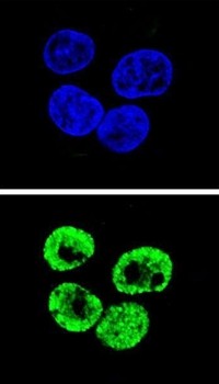  Confocal immunofluoroscence analysis of HepG2 cell using CCNI2 antibody (Center)