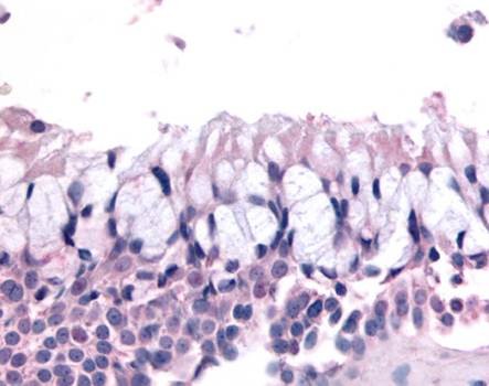 Immunohistochemical staining of paraffin embedded human nasal mucosa respiratory epithelium tissue using OR6K3 antibody (primary antibody at 1:200)