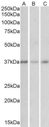  Western blot analysis of staining of Human Cerebellum (A), Duodenum (B) and Heart (C) cell lysates using GHITM antibody.