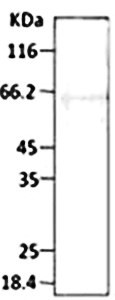 Western blot analysis of PF11_0513 using Hsp40 antibody