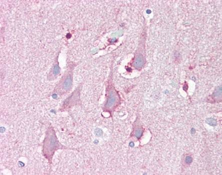 Immunohistochemical staining of paraffin embedded human brain tissue using FBXL16 antibody (primary antibody at 1:200)