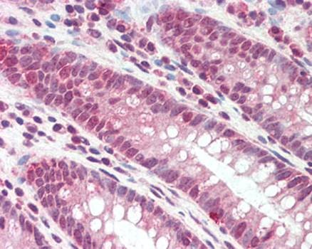Immunohistochemical staining of paraffin embedded human colon tissue using DEFB107 antibody (primary antibody at 1:200)
