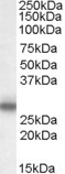 orb19823 (0.1ug/ml) staining of Rat Spinal Cord lysate (35ug protein in RIPA buffer). Primary incubation was 1 hour. Detected by chemiluminescence.