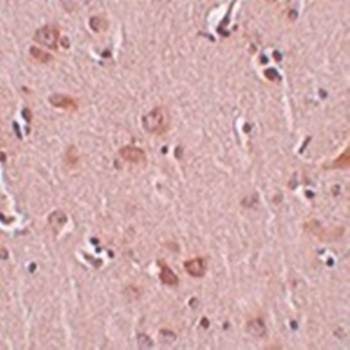  Immunohistochemical analysis of formalin-fixed and paraffin-embedded human liver tissue at 5 ug/mL using PLEKHM2 antibody