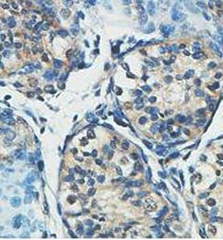 Immunohistochemical analysis of formalin-fixed paraffin embedded fetal testis showing cytoplasmic tissue using HERC6 antibody