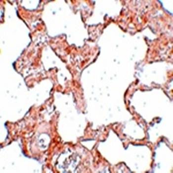  Immunohistochemical analysis of formalin-fixed and paraffin-embedded rat lung tissue at 2.5 ug/mL using VLK antibody
