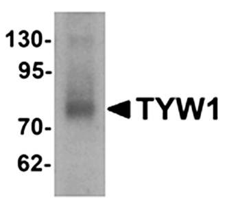 Western blot analysis of human lung tissue lysate at 1 ug/mL using TYW1 antibody