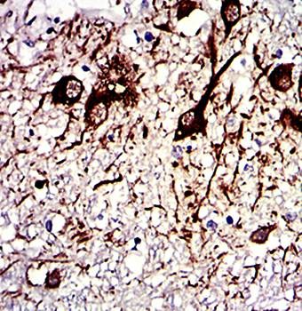  Immunohistochemical analysis of formalin fixed and paraffin-embedded medulla oblongata tissues using TUBA8 antibody 