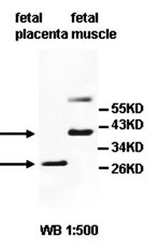 Western blot analysis of fetal placenta and muscle lysate using ADPRHL1 antibody