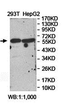  Western blot analysis of 293T and HepG2 cell lysate using FGD5 antibody