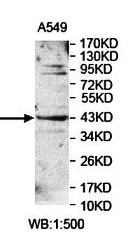 Western blot analysis of A549 cell lysate using LPGAT1 antibody 
