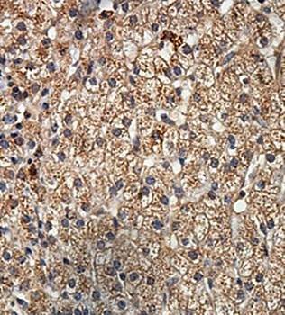  Immunohistochemical analysis of formalin-fixed paraffin embedded fetal liver showing cytoplasmic staining using LPGAT1 antibody