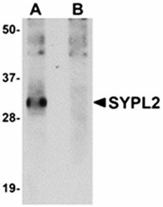 Western blot analysis of human spleen tissue lysate at 1 ug/mL in (A) the absence and (B) the presence of blocking peptide using SYPL2 antibody 
