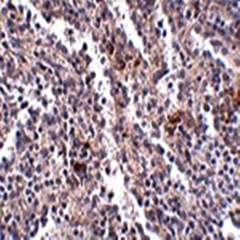  Immunohistochemical analysis of formalin-fixed and paraffin-embedded human spleen tissue at 2.5 ug/mL using SYPL2 antibody