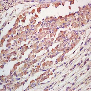 Immunohistochemical analysis of formalin-fixed and paraffin embedded mouse embryo tissue ( dilution at:1:200) using TRAK1 antibody 