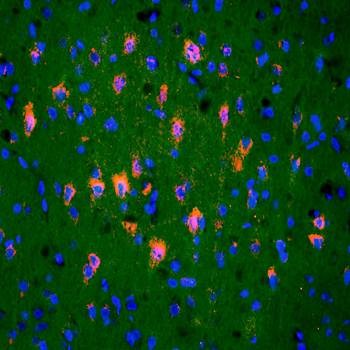  IHC-P of rat brain tissue (dilution at:1:200) using TRAK1 antibody 