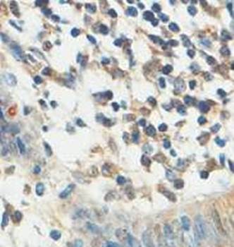 Immunohistochemical analysis of formalin-fixed paraffin embedded fetal colon showing cytoplasmic and nuclear staining using ACBD4 antibody 