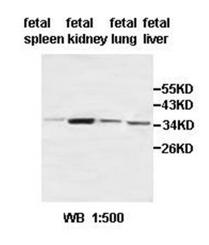  Western blot analysis of fetal spleen,kidney,lung and fetal liver lysate using ACBD4 antibody