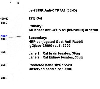 Western blot analysis of rat brain lysates(30ug), rat kidney lysates(30ug) using CYP7A1 antibody