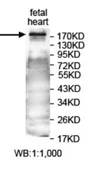 Western blot analysis of fetal heart lysate using ANKRD50 antibody 
