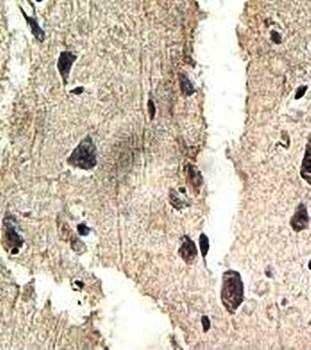 Immunohistochemical analysis of formalin-fixed paraffin embedded fetal brain staining using ANKRD50 antibody