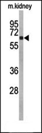 Western blot analysis of mouse kidney tissue lysate using CYP27B1 antibody 