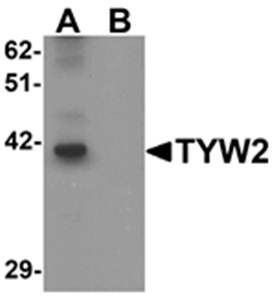 Western blot analysis of K562 cell lysate at 0.5 ug/mL in (A) the absence and (B) the presence of blocking peptide using TYW2 antibody