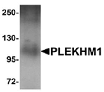Western blot analysis of human lung tissue lysate at 1 ug/mL using PLEKHM1 antibody 
