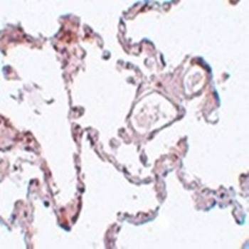  Immunohistochemical analysis of formalin-fixed and paraffin-embedded human lung tissue at 5 ug/mL using PLEKHM1 antibody