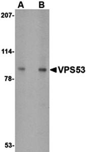 Western blot analysis of 293 cell lysate at (A) 0.5 and (B) 1 ug/mL using VPS53 antibody 