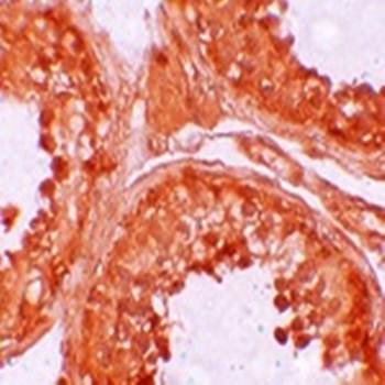  Immunohistochemical analysis of formalin-fixed and paraffin-embedded human testis tissue at 10 ug/mL using NOD6 antibody