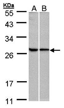 Western Blot analysis of A:293T, B:Hela whole cell lysate using RPL13A antibody 