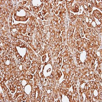 Immunohistochemical analysis of formalin-fixed and paraffin-embedded NCI-N87 xenograft using RPL13A antibody