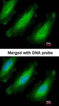 Confocal immunofluorescence analysis of paraformaldehyde-fixed HeLa using RPL13A antibody