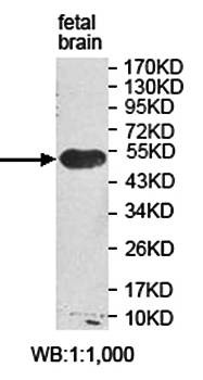 Western blot analysis of fetal brain lysate using ORC5L antibody 