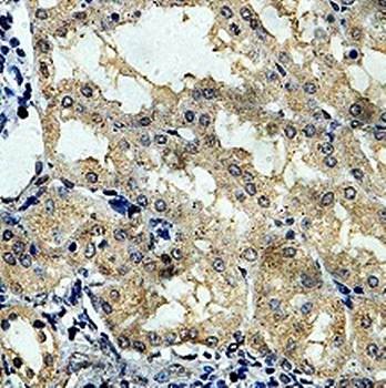  Immunohistochemical analysis of formalin-fixed paraffin embedded fetal brain showing cytoplasmic and nuclear staining using ORC5L antibody
