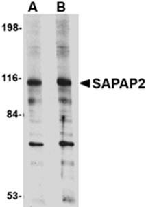 Western blot analysis of L1210 cell lysate at (A) 0.5 and (B) 1 ug/mL using SAPAP2 antibody 