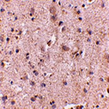  Immunohistochemical analysis of formalin-fixed and paraffin-embedded human brain at 5 ug/mL using SAPAP2 antibody