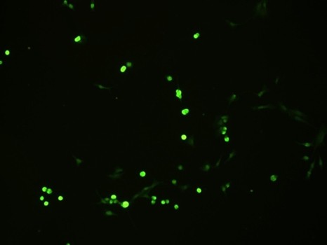 Immunoflurocence analysis of EGFR mutation on non-small cell lung cancer using EGFRvIII antibody 
