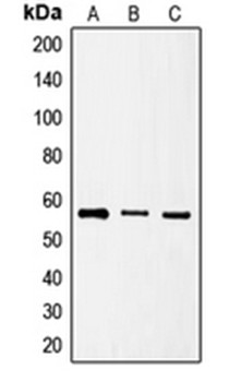 Western blot analysis of HeLa (Lane 1), HT1080 (Lane 2), NIH3T3 (Lane 3) whole cell lysates using SRSF4 antibody 