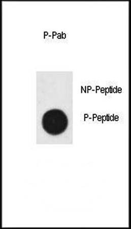  Western blot analysis of Cleaved-CASP3 (Asp175) antibody in nitrocellulose membrane lysates