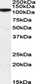 Western blot analysis of Human Cerebellum lysate (35