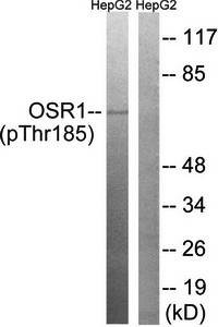 Western blot analysis of extracts from HepG2 cells using OSR1 (phospho-Thr185) antibody 