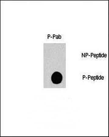  Western blot analysis of Phospho-RAF1-pS338 antibody in nitrocellulose membrane lysates
