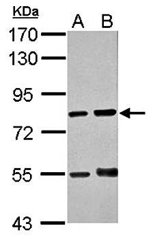 Western Blot analysis of A:THP-1, B:HL-60 whole cell lysate using RED antibody 