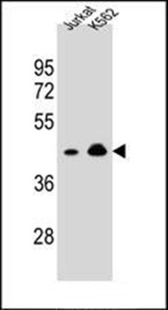 Western blot analysis of Jurkat, K562 cell line lysates (35ug/lane) using OR10A4 antibody (C-term)