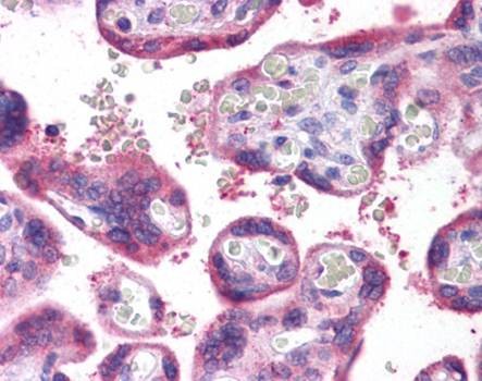 Immunohistochemical staining of paraffin embedded human placenta tissue using WDR92 antibody (primary antibody at 1:200)