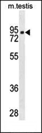  Western blot analysis of CLPX antibody in 293 cell line lysates 